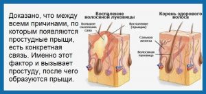 прыщ