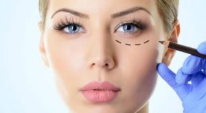 Лазерная блефаропластика и другие самые популярные пластические операции