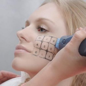 Какими аппаратными процедурами можно убрать морщины на лбу?