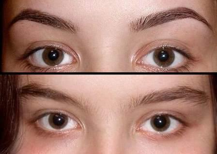 биотатуаж фото до и после