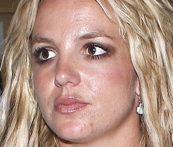 3 основных правила по уходу за жирной кожей лица. Ошибки и рекомендации